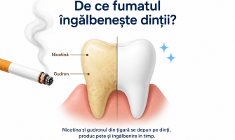 De ce fumatul îngălbenește dinții? Cauze, efecte și cum poți preveni petele