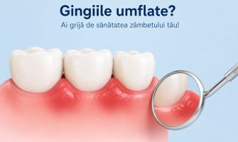 Gingiile umflate – când trebuie să mergi la dentist?