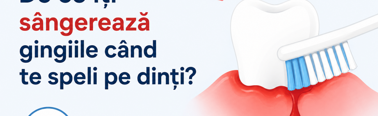 De ce îți sângerează gingiile când te speli pe dinți? De ce îți sângerează gingiile când te speli pe dinți?