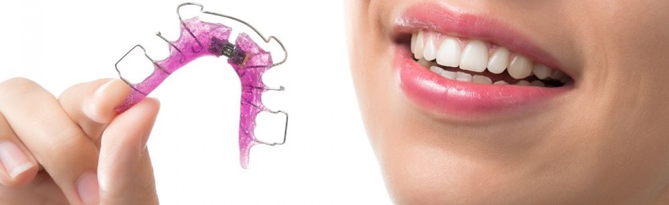 Pasi necesari pentru igiena aparatelor dentare Pasi necesari pentru igiena aparatelor dentare